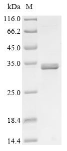 Recombinant Human Choline transporter-like protein 4 (SLC44A4), partial (CSB-EP681506HU1)