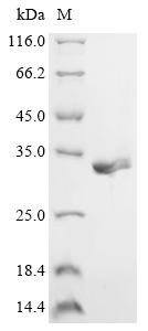 Recombinant Adeno-associated virus 2 Protein Rep78 (Rep78), partial (CSB-EP3989ADB)