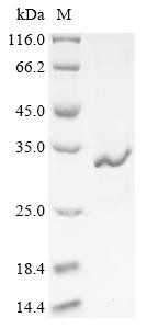 Recombinant Clostridium tetani Tetanus toxin, partial (CSB-EP4606CMN3)