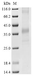 Recombinant Human Delta-type opioid receptor (OPRD1) (CSB-CF016358HU)