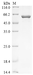 Recombinant Arabidopsis thaliana Acetolactate synthase, chloroplastic (ALS), partial (CSB-EP321540DOA)