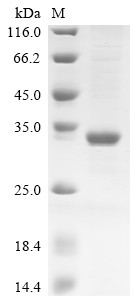 Recombinant Bovine Butyrophilin subfamily 1 member A1 (BTN1A1), partial (CSB-EP002869BO1b1)