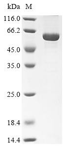 Recombinant Bovine Retinal dehydrogenase 1 (ALDH1A1) (CSB-EP001565BO)
