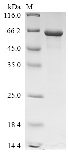 Recombinant Human Cocaine esterase (CES2) (CSB-EP005259HU)