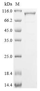 Recombinant Human Cholesterol side-chain cleavage enzyme, mitochondrial (CYP11A1), Biotinylated (CSB-EP006389HU-B)