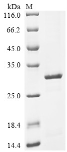 Recombinant Human cytomegalovirus Major capsid protein (MCP), partial (CSB-EP322308HWVc7)
