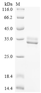Recombinant Chicken Neurofibromin (NF1), partial (CSB-EP015734CH)