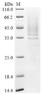 Recombinant Human Cathepsin B (CTSB) (CSB-YP006185HU)