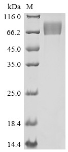 Recombinant Human Fibroblast growth factor receptor 1 (FGFR1), partial (CSB-MP008642HUc7)