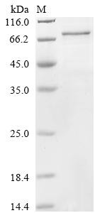 Recombinant Human Cysteine-rich secretory protein LCCL domain-containing 1 (CRISPLD1) (CSB-CF884457HU)