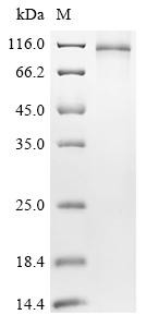 Recombinant Acinetobacter baumannii Efflux pump membrane transporter (HMPREF0010_00594) (CSB-CF4780GTJ)