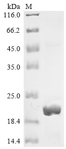 Recombinant Human C-Jun-amino-terminal kinase-interacting protein 4 (SPAG9), partial (CSB-EP022470HU)