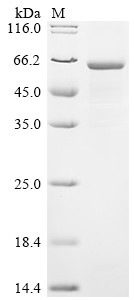 Recombinant Human CCR4-NOT transcription complex subunit 6-like (CNOT6L) (CSB-EP846658HUa0)