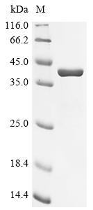Recombinant Human Carbonic anhydrase 6 (CA6) (CSB-EP004377HU)