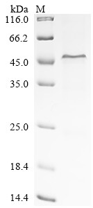 Recombinant Human Complement factor H (CFH), partial (CSB-EP005273HU(F1))