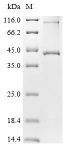 Recombinant Dictyostelium discoideum Putative ZDHHC-type palmitoyltransferase 8 (DDB_G0280329) (CSB-CF706883DKK)
