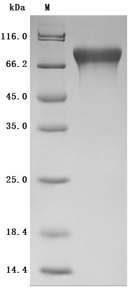 Recombinant Human Cell adhesion molecule 1 (CADM1), partial (Active) (CSB-MP004425HU)