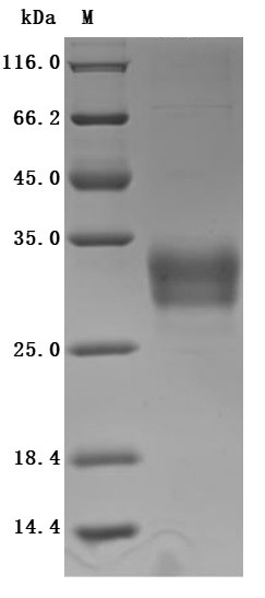 Recombinant Human C-type lectin domain family 4 member C (CLEC4C), partial (Active) (CSB-MP855470HUh7)