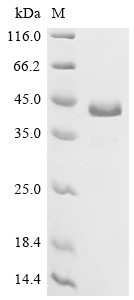 Recombinant Human Delta-like protein 3 (DLL3), partial (Active) (CSB-MP882142HU3)