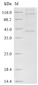 Recombinant Human Chemerin-like receptor 1 (CMKLR1) (CSB-CF005614HUd7)