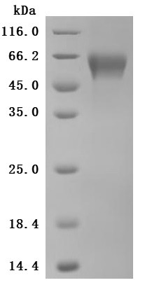 Recombinant Human Cytotoxic and regulatory T-cell molecule (CRTAM), partial (Active) (CSB-MP005998HU1d7)