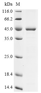 Recombinant Chlamydophila psittaci Major outer membrane porin (ompA) (CSB-EP669359DSM)