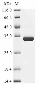 Recombinant Bordetella bronchiseptica Pertussis toxin subunit 1 homolog (ptxA) (CSB-EP743040BTY)