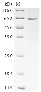 Recombinant Human Cellular tumor antigen p53 (TP53) (Y220C) (CSB-EP024077HU(M1))