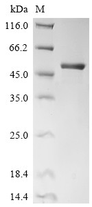 Recombinant Human Enoyl-CoA hydratase, mitochondrial (ECHS1) (CSB-EP007382HU)