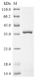 Recombinant Drosophila melanogaster Protein nanos (nos), partial (CSB-EP340723DLU1)