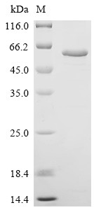 Recombinant Human Copper-transporting ATPase 2 (ATP7B), partial (CSB-EP002415HU)