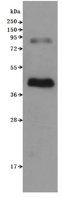 Recombinant Human C-C chemokine receptor type 6 (CCR6)-VLPs (Active) (CSB-MP004845HU)