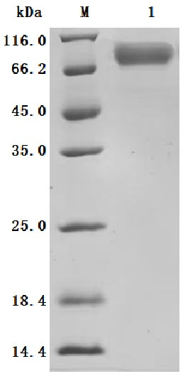 Recombinant Human Dipeptidase 3 (DPEP3), partial (Active) (CSB-MP007125HU)