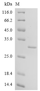 Recombinant Bovine Cell death activator CIDE-B (CIDEB), partial (CSB-EP664896BO1)