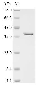 Recombinant Anisakis simplex Paramyosin (PARA), partial (CSB-EP885669BZJ)