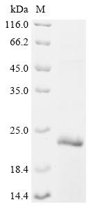 Recombinant Human Complement receptor type 1 (CR1), partial (CSB-EP005932HUe1)