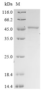 Recombinant Aspergillus fumigatus Protein ecm33 (ecm33) (CSB-EP684207NGSc7)