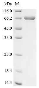 Recombinant Human DCC-interacting protein 13-alpha (APPL1), partial (CSB-EP890917HU1)