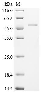 Recombinant Human Ataxin-3 (ATXN3) (CSB-EP002443HU)
