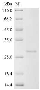 Recombinant Human cytomegalovirus Protein UL16 (UL16), partial (CSB-EP325853HWV)