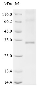 Recombinant Human Aquaporin-7 (AQP7) (CSB-CF001967HU)