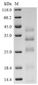 Recombinant Human Cathepsin B (CTSB) (L26V) (CSB-MP006185HU3(M))