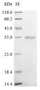 Recombinant Chicken Insulin-like growth factor I (IGF1) (CSB-YP011086CH)