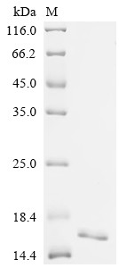Recombinant Human Fatty acid-binding protein, intestinal (FABP2) (CSB-YP007942HUa0)