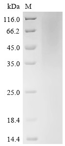 Recombinant Human cytomegalovirus Protein UL16 (UL16), partial (CSB-YP325853HWV)