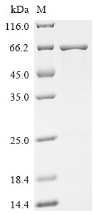 Recombinant Human Carboxylesterase 3 (CES3) (CSB-EP005260HU)