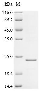 Recombinant Bordetella pertussis Filamentous hemagglutinin (fhaB), partial (CSB-EP5214BUA)