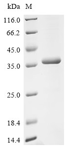 Recombinant Escherichia coli O6:H1 Uncharacterized deoxyribonuclease YcfH (ycfH) (CSB-EP360306EGX)