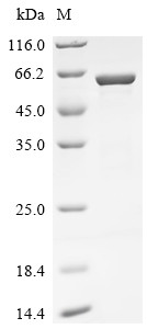 Recombinant Bat coronavirus HKU5 Nucleoprotein (N) (CSB-EP386462BOU)