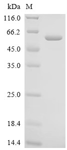 Recombinant Human Angiopoietin-related protein 6 (ANGPTL6) (CSB-EP822824HU)